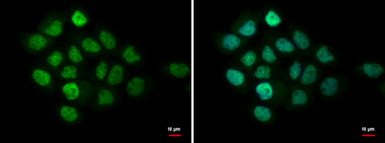Anti-MTA1 antibody [C1C3] used in Immunocytochemistry/ Immunofluorescence (ICC/IF). GTX100610