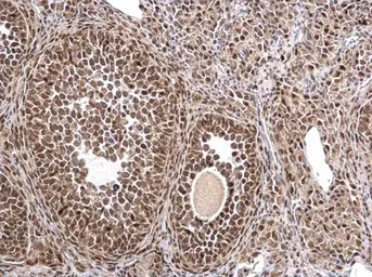 Anti-MTA1 antibody [C1C3] used in IHC (Paraffin sections) (IHC-P). GTX100610