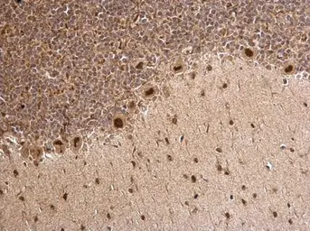 Anti-MTA1 antibody [C1C3] used in IHC (Paraffin sections) (IHC-P). GTX100610