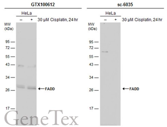 Anti-FADD antibody used in Western Blot (WB). GTX100612