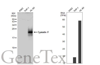 Anti-Cystatin F antibody used in Western Blot (WB). GTX100613