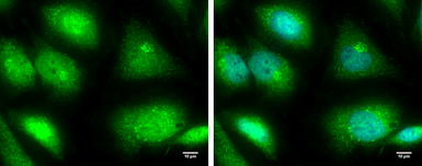 Anti-TRIM25 antibody [N2C1], Internal used in Immunocytochemistry/ Immunofluorescence (ICC/IF). GTX100617