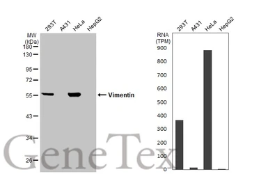 Anti-Vimentin antibody used in Western Blot (WB). GTX100619