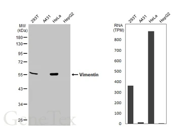 Anti-Vimentin antibody used in Western Blot (WB). GTX100619