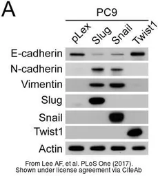 Anti-Twist1 antibody [N1C3] used in Western Blot (WB). GTX100621