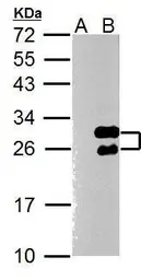 Anti-Twist1 antibody [N1C3] used in Western Blot (WB). GTX100621