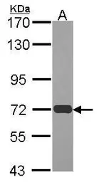 Anti-RAD54L antibody [N1N2-2], N-term used in Western Blot (WB). GTX100624