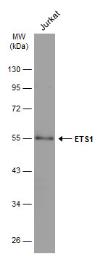 Anti-ETS1 antibody used in Western Blot (WB). GTX100639