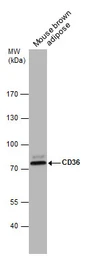 Anti-CD36 antibody [C1C3] used in Western Blot (WB). GTX100642