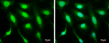 Anti-MDM2 antibody used in Immunocytochemistry/ Immunofluorescence (ICC/IF). GTX100654
