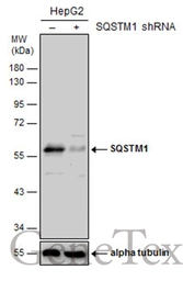 Anti-SQSTM1 / P62 antibody [N3C1], Internal used in Western Blot (WB). GTX100685