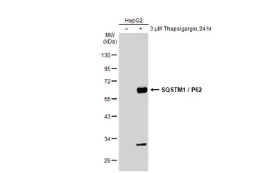 Anti-SQSTM1 / P62 antibody [N3C1], Internal used in Western Blot (WB). GTX100685