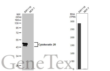 Anti-Cytokeratin 20 antibody [C2C3], C-term used in Western Blot (WB). GTX100693