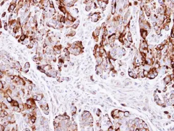 Anti-Cytokeratin 20 antibody [C2C3], C-term used in IHC (Paraffin sections) (IHC-P). GTX100693