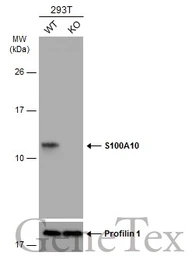 Anti-S100A10 antibody used in Western Blot (WB). GTX100697