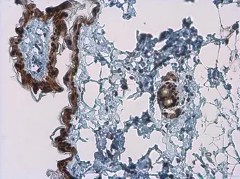 Anti-Kallikrein 7 antibody used in IHC (Paraffin sections) (IHC-P). GTX100700