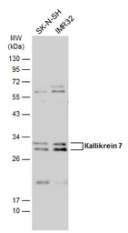 Anti-Kallikrein 7 antibody used in Western Blot (WB). GTX100700
