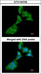 Anti-MMP3 antibody [N1], N-term used in Immunocytochemistry/ Immunofluorescence (ICC/IF). GTX100706