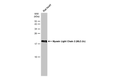 Anti-Myosin Light Chain 2 (MLC-2v) antibody used in Western Blot (WB). GTX100714