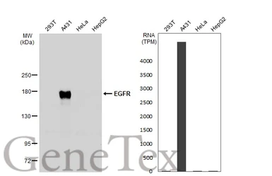 Anti-EGFR antibody [N1], N-term used in Western Blot (WB). GTX100725