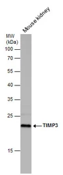 Anti-TIMP3 antibody [N1C3] used in Western Blot (WB). GTX100742