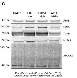 Anti-TGFBI antibody [C1C3] used in Western Blot (WB). GTX100744
