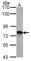 Anti-TGFBI antibody [C1C3] used in Western Blot (WB). GTX100744