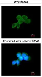 Anti-Syk antibody [N2C2], Internal used in Immunocytochemistry/ Immunofluorescence (ICC/IF). GTX100748