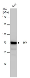 Anti-Syk antibody [N2C2], Internal used in Western Blot (WB). GTX100748