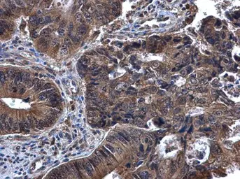 Anti-Syk antibody [N2C2], Internal used in IHC (Paraffin sections) (IHC-P). GTX100748