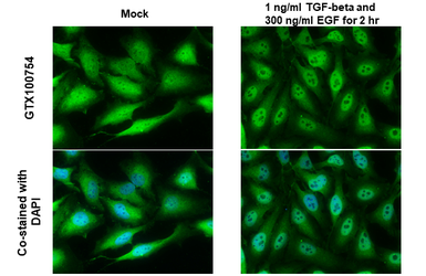 Anti-SNAI1 antibody used in Immunocytochemistry/ Immunofluorescence (ICC/IF). GTX100754