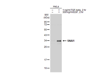 Anti-SNAI1 antibody used in Western Blot (WB). GTX100754