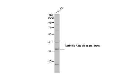 Anti-Retinoic Acid Receptor beta antibody used in Western Blot (WB). GTX100759