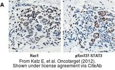 Anti-Rac1 antibody used in IHC (Paraffin sections) (IHC-P). GTX100761