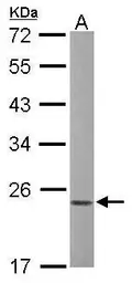 Anti-Rac1 antibody used in Western Blot (WB). GTX100761