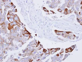 Anti-Rac1 antibody used in IHC (Paraffin sections) (IHC-P). GTX100761