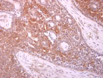 Anti-PTHLH antibody [N1C3] used in IHC (Paraffin sections) (IHC-P). GTX100762