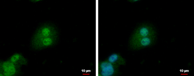 Anti-PTHLH antibody [N1C3] used in Immunocytochemistry/ Immunofluorescence (ICC/IF). GTX100762