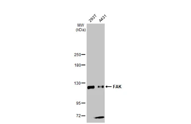 Anti-FAK antibody used in Western Blot (WB). GTX100764