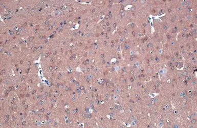 Anti-FAK antibody used in IHC (Paraffin sections) (IHC-P). GTX100764