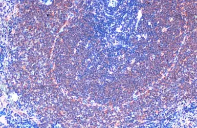 Anti-FAK antibody used in IHC (Paraffin sections) (IHC-P). GTX100764