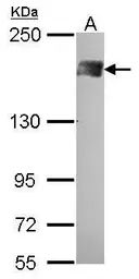 Anti-PB1 antibody [N1N2], N-term used in Western Blot (WB). GTX100781