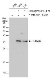 Anti-IL1 beta antibody used in Western Blot (WB). GTX100793