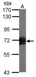 Anti-CD168 / RHAMM antibody used in Western Blot (WB). GTX100795