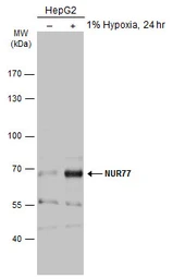 Anti-NUR77 antibody used in Western Blot (WB). GTX100797