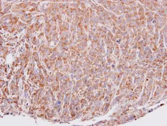 Anti-VEGFD antibody [N3C3] used in IHC (Paraffin sections) (IHC-P). GTX100805