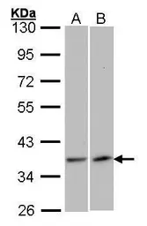 Anti-VEGFD antibody [N3C3] used in Western Blot (WB). GTX100805