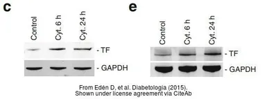 Anti-Coagulation factor III/Tissue Factor antibody [N1C3] used in Western Blot (WB). GTX100808