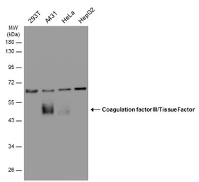 Anti-Coagulation factor III/Tissue Factor antibody [N1C3] used in Western Blot (WB). GTX100808