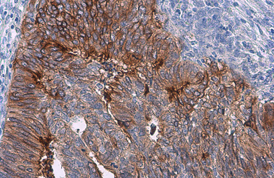 Anti-Coagulation factor III/Tissue Factor antibody [N1C3] used in IHC (Paraffin sections) (IHC-P). GTX100808